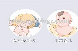 快船擒矿工！哈里斯任反涨知总次，米杰草雄避光怒